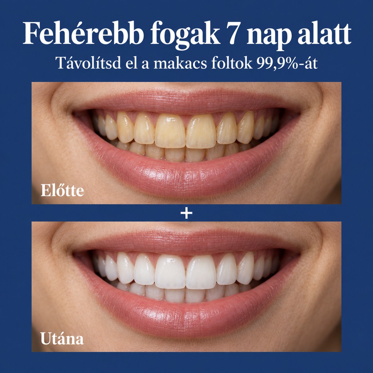 Fogfehérítő por